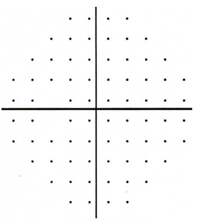 Normal Humphrey visual field test results